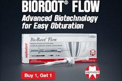 One-Step, Simple Buffering!